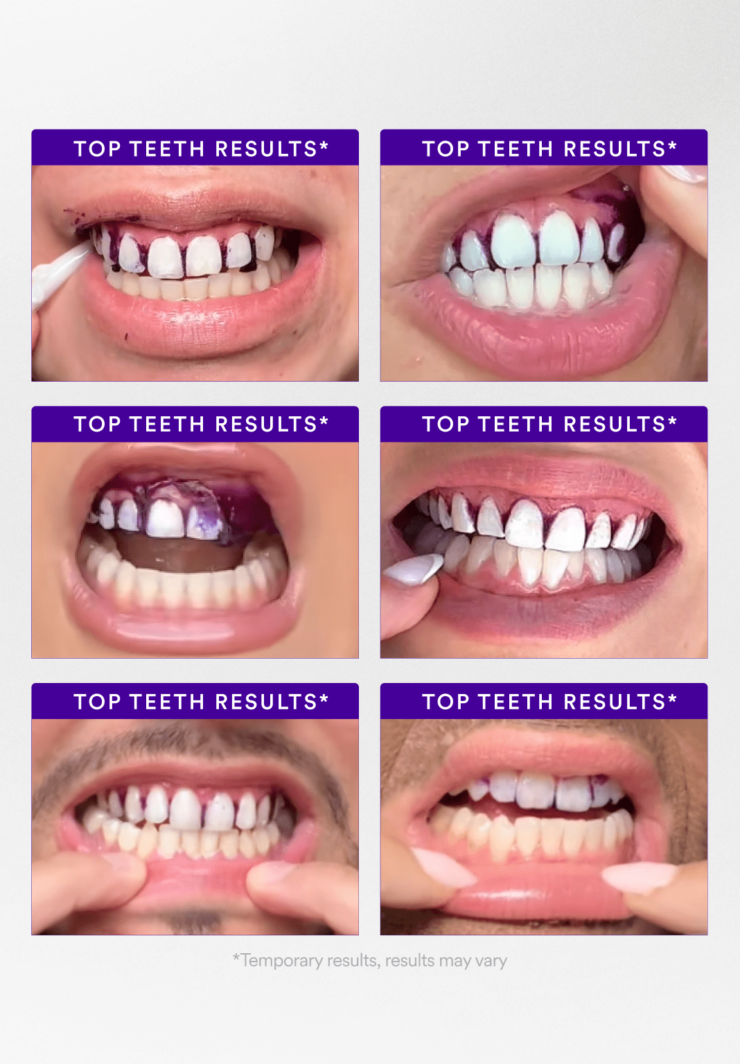 Buy 2 Get 1 Free - V34 Whitening Strips