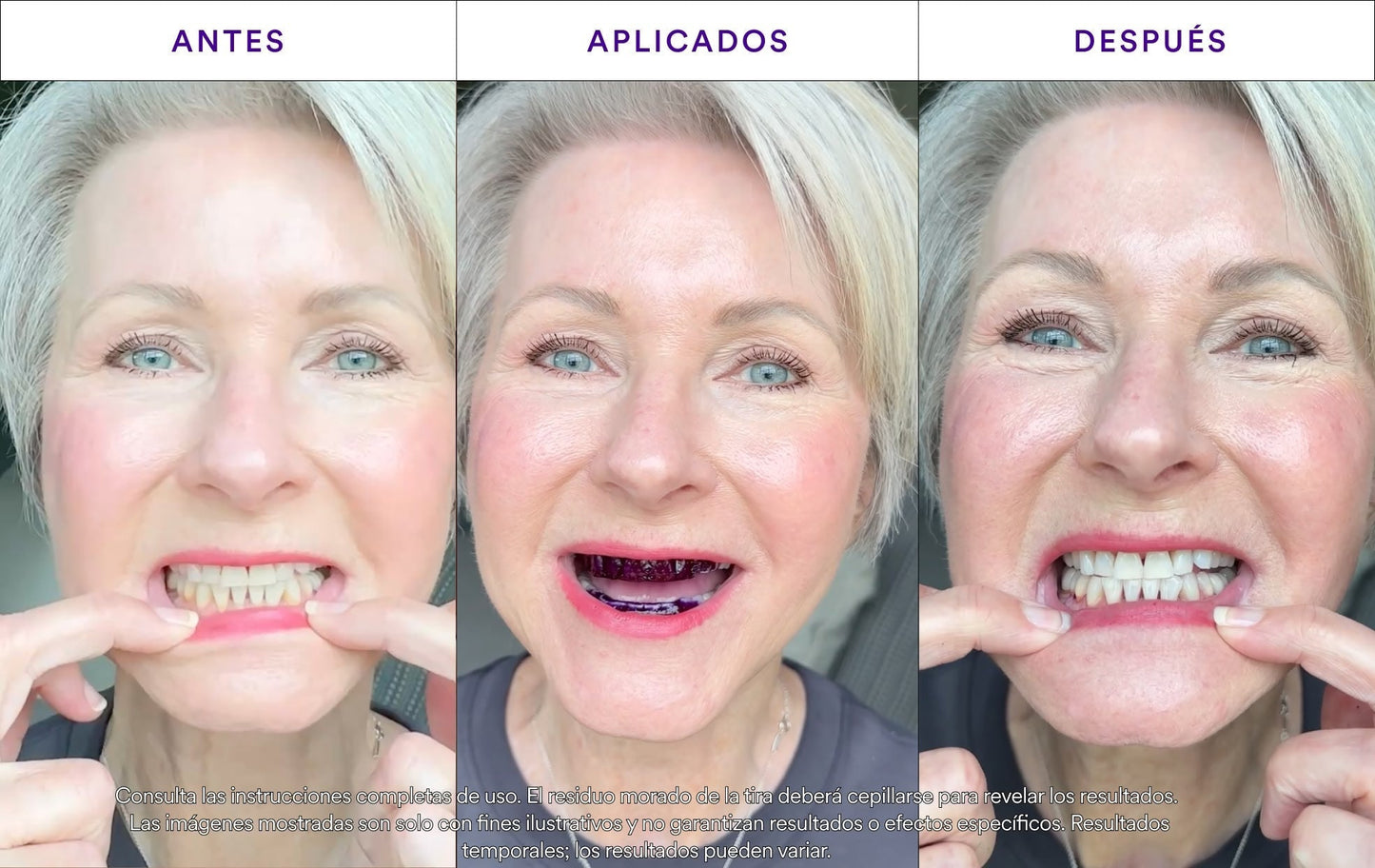 Tiras Blanqueadoras V34