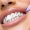 SmileStika Fast Food Pack